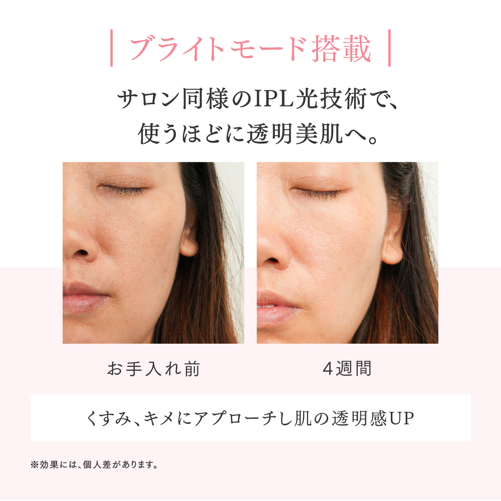 MiRAY AIRはブライトモードで肌のくすみやキメのケアが可能です