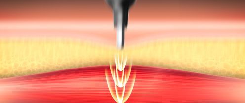 ポスポスハンディガン。フェイスポイント。表情筋ケアイメージ。